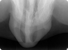 Radiografia Oclusal